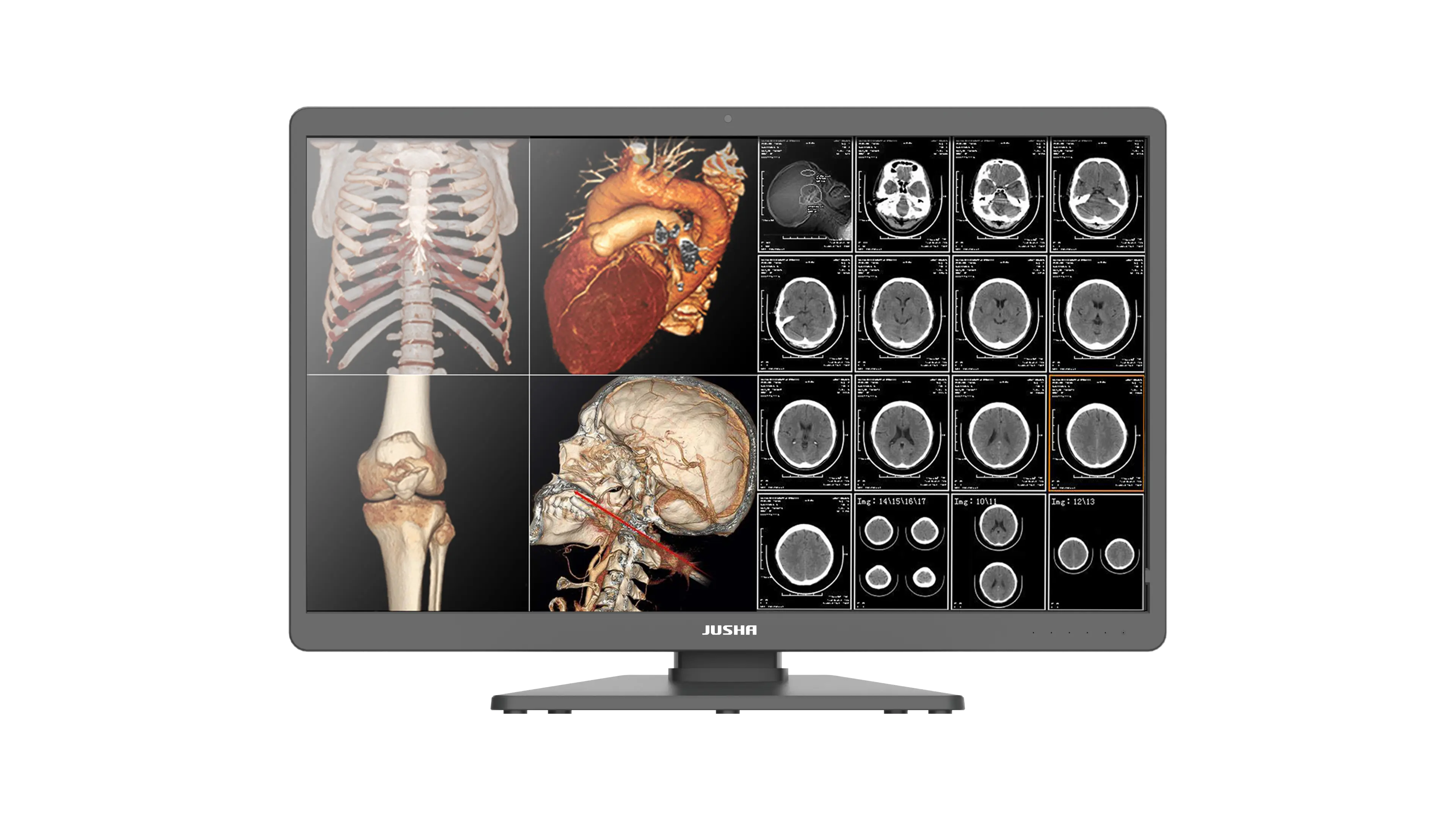 Diagnostický monitor C820G
